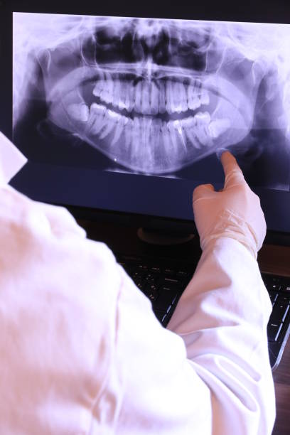 Best Same-Day Emergency Dental Services in Fulton, TX