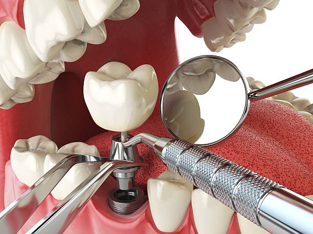 Best Weekend Emergency Dentist in Fulton, TX